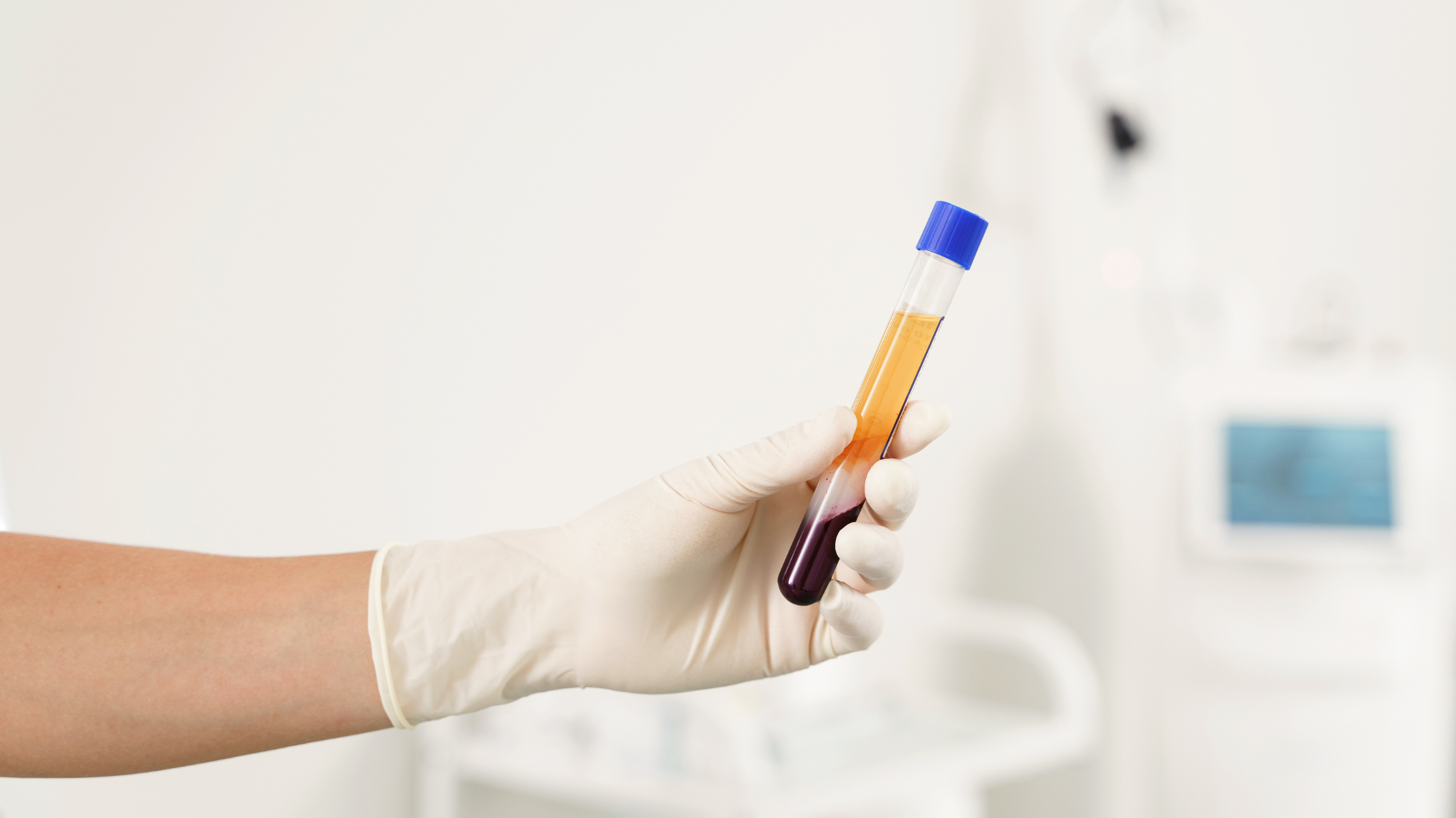 PRP Injections