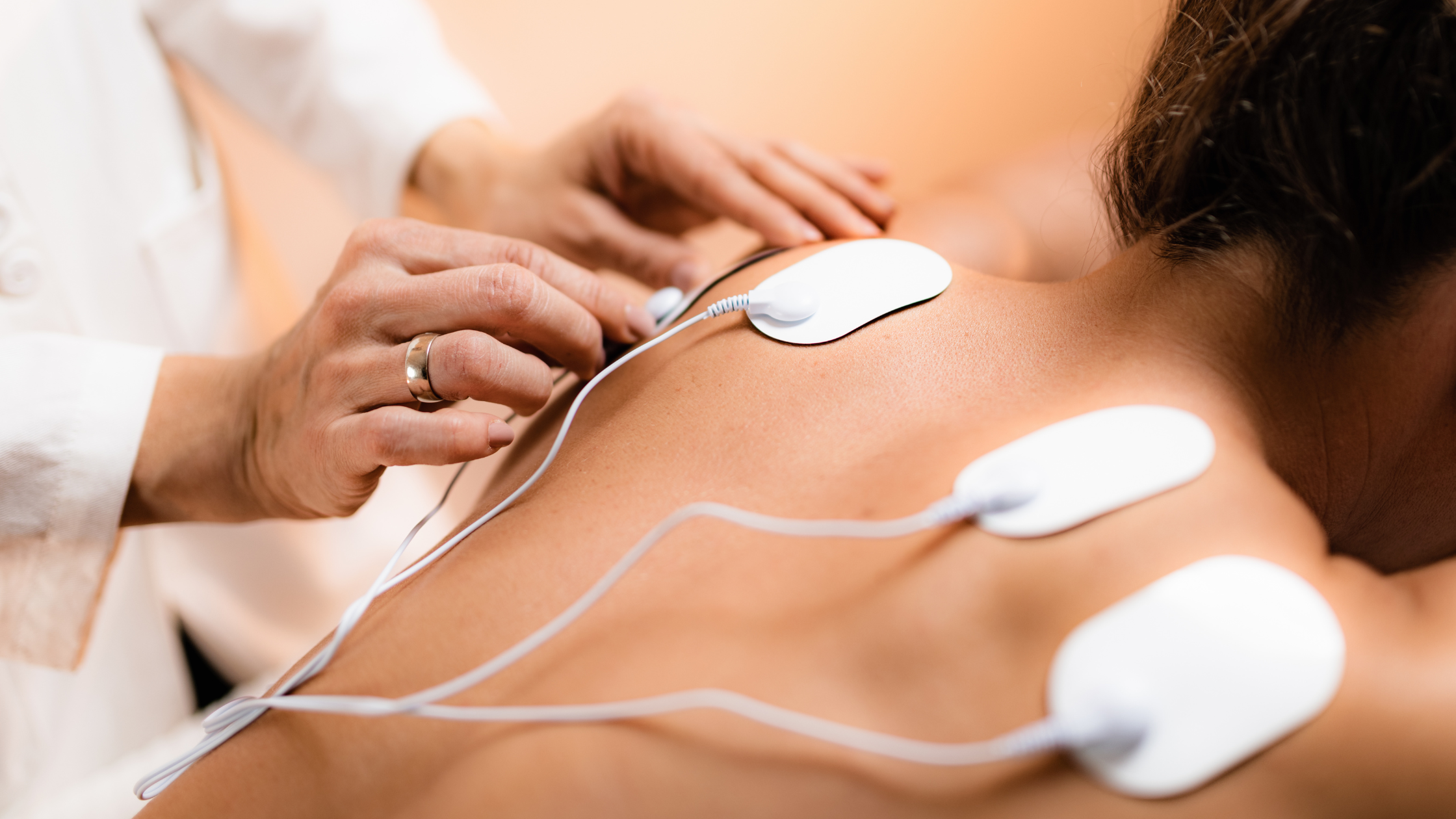 peripheral nerve stimulation