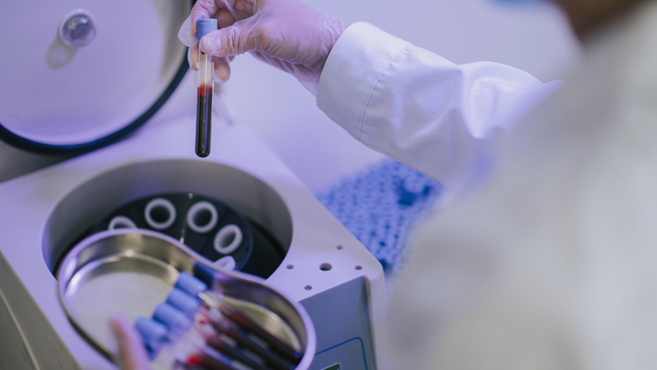 prp therapy