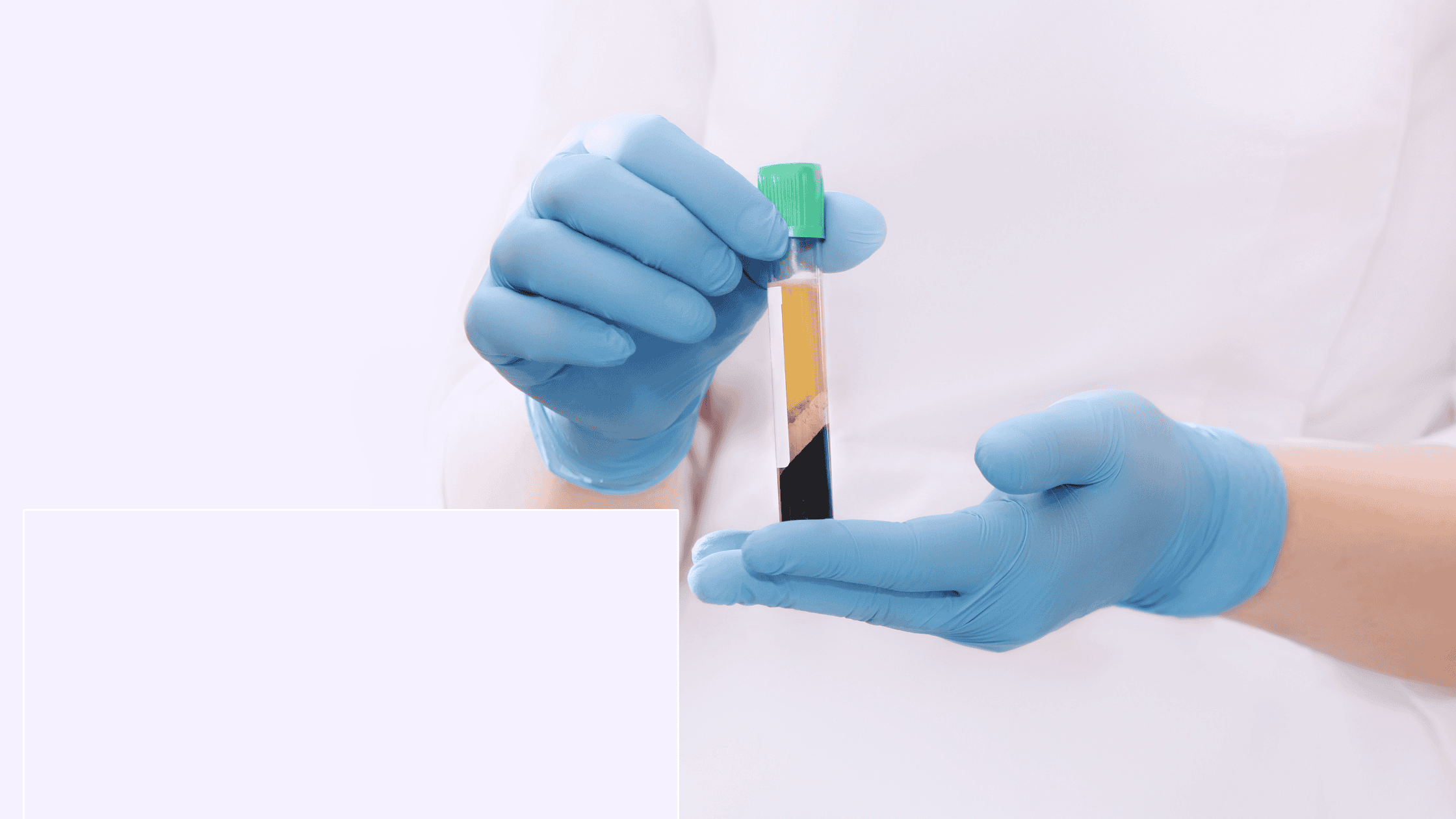 PRP vs cortisone