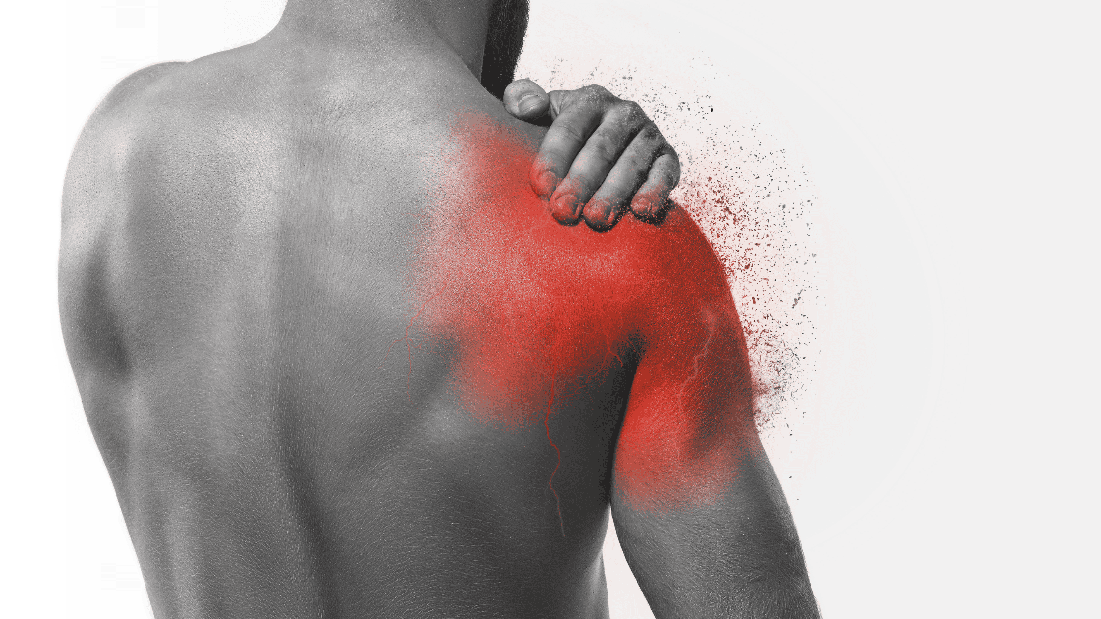 rotator cuff tear and frozen shoulder
